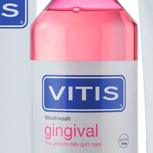Gingivitis and Paradontitis